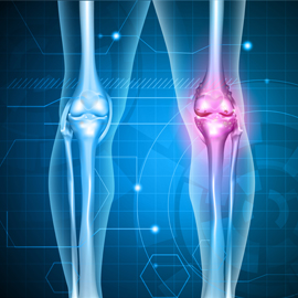The Weight Loss-Knee Pain Connection
